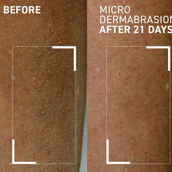 Dr. Brandt Microderbrasionsion Body Polishing Exfoliator - Picture 2 of 8